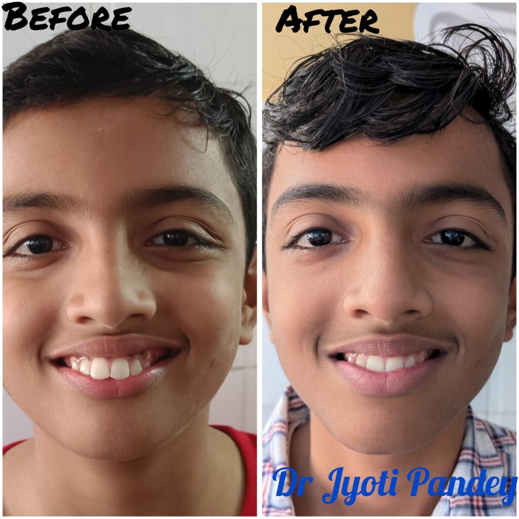 Risks of Delaying Dental or Orthodontic Treatment