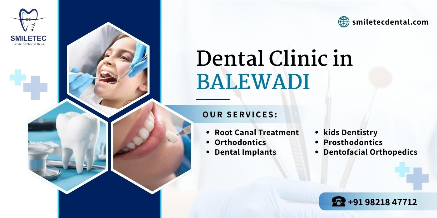 Dental Clinic in Balewadi
