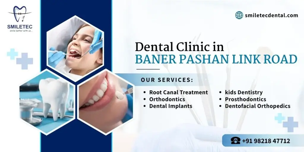 Dental Clinic in Baner Pashan Link Road