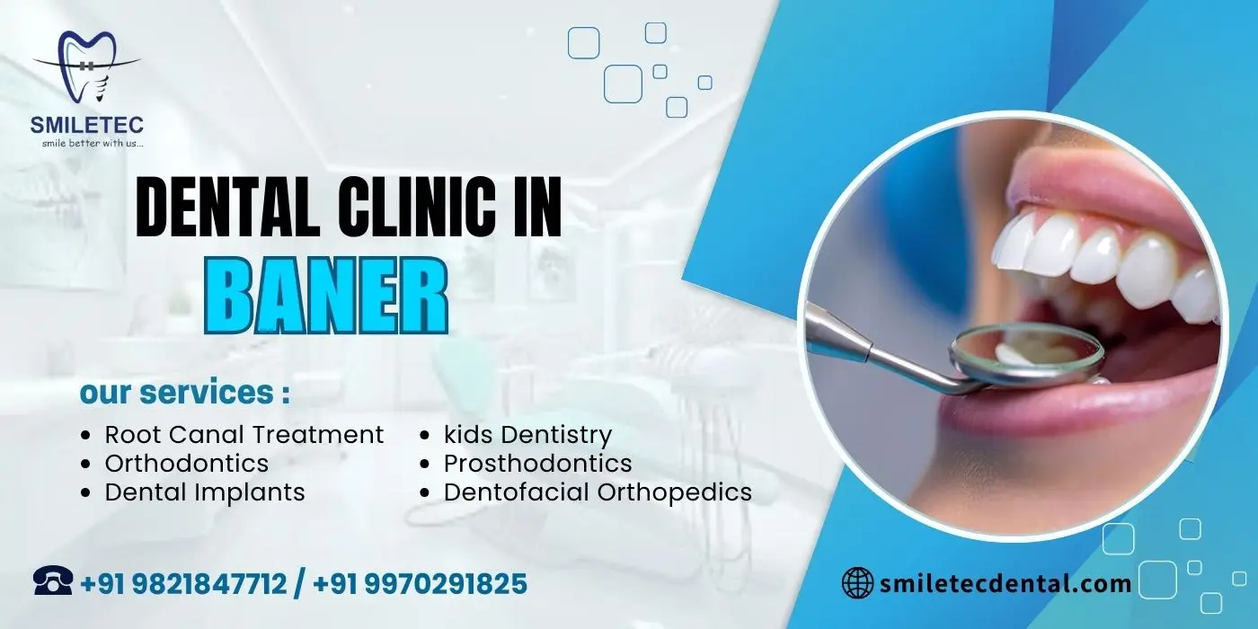 Dental clinic in Baner