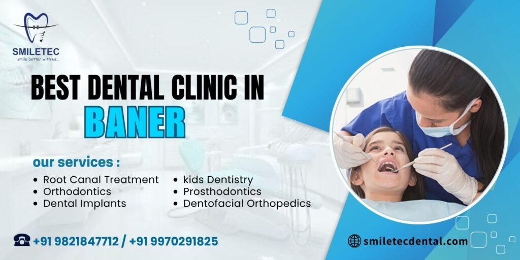 Best dental clinic in Baner