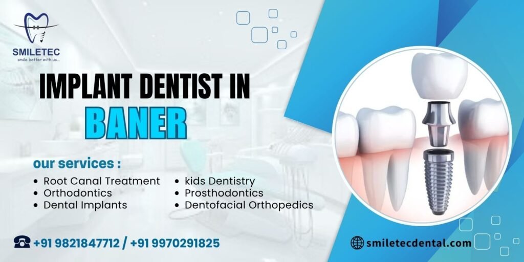 Implant dentist in Baner