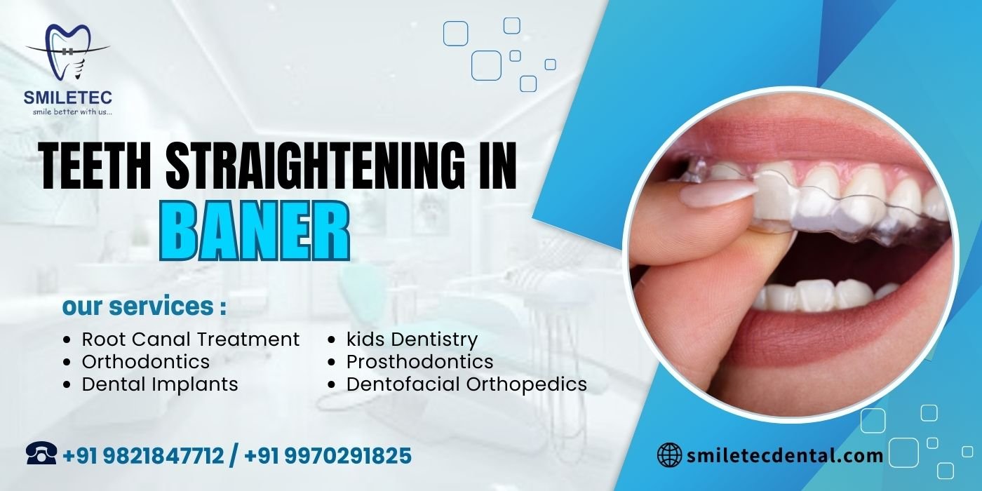 Teeth straightening in Baner