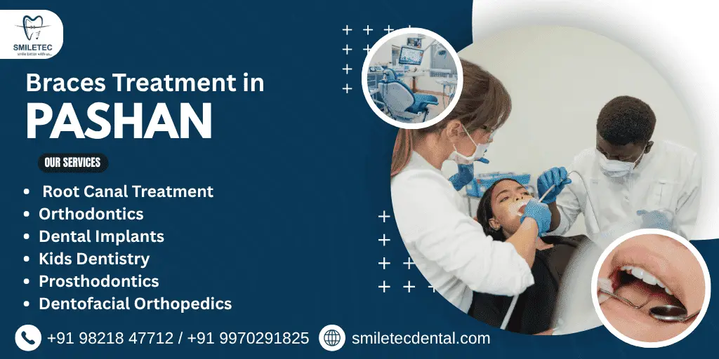 Braces treatment in Pashan