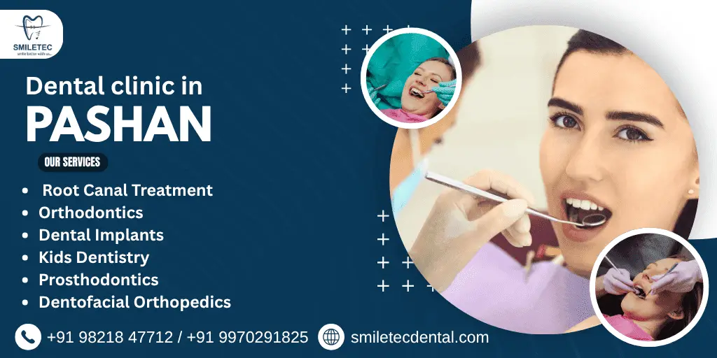Dental clinic in pashan