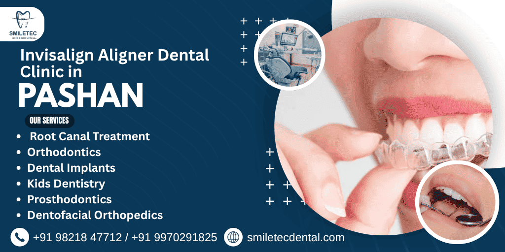 Invisalign Aligner dental clinic in pashan